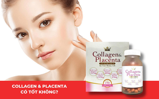 Viên uống chống lão hóa Collagen Placenta 5 in 1 Nhật Bản có tốt không